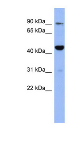 ZNF569 Antibody - ZNF569 antibody Western blot of Fetal Thymus lysate. This image was taken for the unconjugated form of this product. Other forms have not been tested.