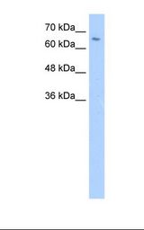 ZNF57 Antibody - Jurkat cell lysate. Antibody concentration: 5.0 ug/ml. Gel concentration: 12%.  This image was taken for the unconjugated form of this product. Other forms have not been tested.
