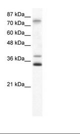 ZNF570 Antibody - Jurkat Cell Lysate.  This image was taken for the unconjugated form of this product. Other forms have not been tested.