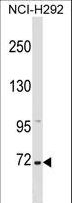 ZNF571 Antibody - ZNF571 Antibody western blot of NCI-H292 cell line lysates (35 ug/lane). The ZNF571 antibody detected the ZNF571 protein (arrow).