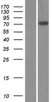 ZNF571 Protein - Western validation with an anti-DDK antibody * L: Control HEK293 lysate R: Over-expression lysate