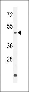 ZNF572 Antibody - ZN572 Antibody western blot of K562 cell line lysates (35 ug/lane). The ZN572 antibody detected the ZN572 protein (arrow).