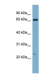 ZNF572 Antibody - ZNF572 antibody Western blot of COLO205 cell lysate. This image was taken for the unconjugated form of this product. Other forms have not been tested.
