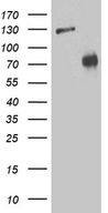 ZNF572 Antibody - HEK293T cells were transfected with the pCMV6-ENTRY control. (Left lane) or pCMV6-ENTRY ZNF572. (Right lane) cDNA for 48 hrs and lysed. Equivalent amounts of cell lysates. (5 ug per lane) were separated by SDS-PAGE and immunoblotted with anti-ZNF572. (1:2000)