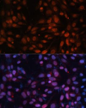 ZNF574 Antibody - Immunofluorescence analysis of NIH/3T3 cells using ZNF574 Polyclonal Antibody at dilution of 1:100.Blue: DAPI for nuclear staining.
