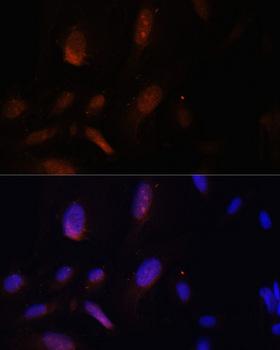 ZNF574 Antibody - Immunofluorescence analysis of U-2OS cells using ZNF574 Polyclonal Antibody at dilution of 1:100.Blue: DAPI for nuclear staining.
