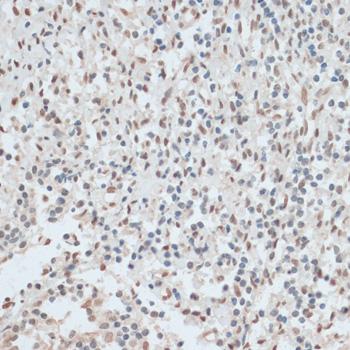 ZNF574 Antibody - Immunohistochemistry of paraffin-embedded Human tonsil using ZNF574 Polyclonal Antibody at dilution of 1:100 (40x lens).