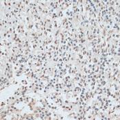 ZNF574 Antibody - Immunohistochemistry of paraffin-embedded Human tonsil using ZNF574 Polyclonal Antibody at dilution of 1:100 (40x lens).