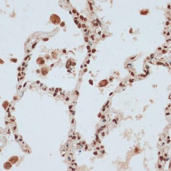 ZNF574 Antibody - Immunohistochemistry of paraffin-embedded Human lung using ZNF574 Polyclonal Antibody at dilution of 1:100 (40x lens).
