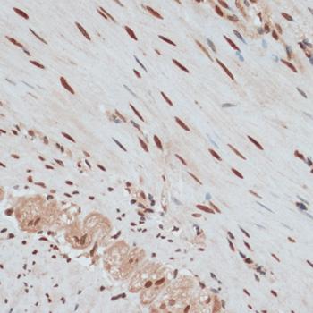 ZNF574 Antibody - Immunohistochemistry of paraffin-embedded Human smooth muscle using ZNF574 Polyclonal Antibody at dilution of 1:100 (40x lens).