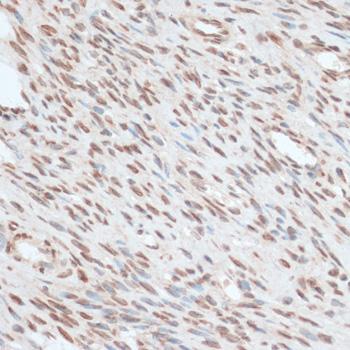 ZNF574 Antibody - Immunohistochemistry of paraffin-embedded Human uterus using ZNF574 Polyclonal Antibody at dilution of 1:100 (40x lens).
