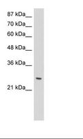 ZNF575 Antibody - Jurkat Cell Lysate.  This image was taken for the unconjugated form of this product. Other forms have not been tested.