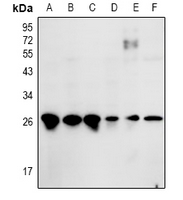 ZNF575 Antibody - Western blot analysis of ZNF575 expression in Hela (A), CT26 (B), AML12 (C), C6 (D), H9C2 (E), MEF (F) whole cell lysates.