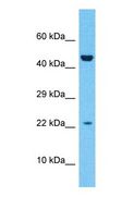 ZNF576 Antibody - Western blot of ZN576 Antibody with human Fetal Liver lysate.  This image was taken for the unconjugated form of this product. Other forms have not been tested.