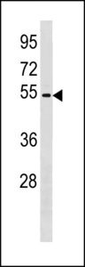 ZNF577 Antibody - ZNF577 Antibody western blot of Jurkat cell line lysates (35 ug/lane). The ZNF577 antibody detected the ZNF577 protein (arrow).