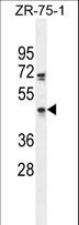 ZNF578 Antibody - ZNF578 Antibody western blot of ZR-75-1 cell line lysates (35 ug/lane). The ZNF578 antibody detected the ZNF578 protein (arrow).
