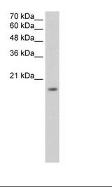 ZNF580 Antibody - Jurkat Cell Lysate.  This image was taken for the unconjugated form of this product. Other forms have not been tested.