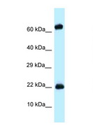 ZNF580 Antibody - ZNF580 antibody Western blot of Mouse Spleen lysate. Antibody concentration 1 ug/ml.  This image was taken for the unconjugated form of this product. Other forms have not been tested.