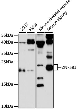 ZNF581 Antibody - Western blot analysis of extracts of various cell lines, using ZNF581 antibody at 1:3000 dilution. The secondary antibody used was an HRP Goat Anti-Rabbit IgG (H+L) at 1:10000 dilution. Lysates were loaded 25ug per lane and 3% nonfat dry milk in TBST was used for blocking. An ECL Kit was used for detection and the exposure time was 90s.