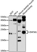 ZNF581 Antibody - Western blot analysis of extracts of various cell lines, using ZNF581 antibody at 1:3000 dilution. The secondary antibody used was an HRP Goat Anti-Rabbit IgG (H+L) at 1:10000 dilution. Lysates were loaded 25ug per lane and 3% nonfat dry milk in TBST was used for blocking. An ECL Kit was used for detection and the exposure time was 90s.