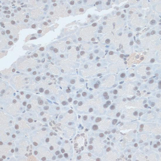 ZNF581 Antibody - Immunohistochemistry of paraffin-embedded Rat pancreas using ZNF581 Polyclonal Antibody at dilution of 1:100 (40x lens).