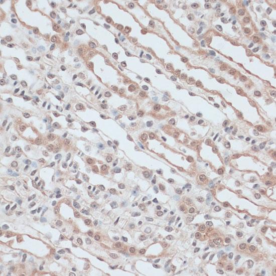 ZNF581 Antibody - Immunohistochemistry of paraffin-embedded Mouse kidney using ZNF581 Polyclonal Antibody at dilution of 1:100 (40x lens).