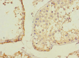 ZNF582 Antibody - Immunohistochemistry of paraffin-embedded human testis tissue using ZNF582 Antibody at dilution of 1:100