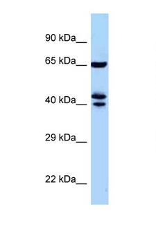 ZNF583 Antibody - ZNF583 antibody Western blot of Mouse Pancreas lysate. Antibody concentration 1 ug/ml.  This image was taken for the unconjugated form of this product. Other forms have not been tested.