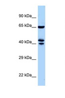ZNF583 Antibody - ZNF583 antibody Western blot of Mouse Pancreas lysate. Antibody concentration 1 ug/ml.  This image was taken for the unconjugated form of this product. Other forms have not been tested.