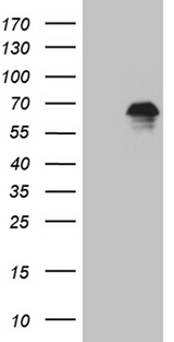 ZNF583 Antibody - HEK293T cells were transfected with the pCMV6-ENTRY control. (Left lane) or pCMV6-ENTRY ZNF583. (Right lane) cDNA for 48 hrs and lysed. Equivalent amounts of cell lysates. (5 ug per lane) were separated by SDS-PAGE and immunoblotted with anti-ZNF583. (1:2000)