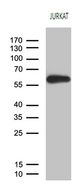 ZNF583 Antibody - Western blot analysis of extracts. (35ug) from jurkat cell line by using anti-ZNF583 monoclonal antibody. (1:500)