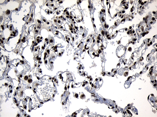 ZNF583 Antibody - Immunohistochemical staining of paraffin-embedded Human lung tissue within the normal limits using anti-ZNF583 mouse monoclonal antibody. (Heat-induced epitope retrieval by 1mM EDTA in 10mM Tris buffer. (pH8.5) at 120°C for 3 min. (1:500)
