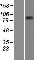 ZNF585B Protein - Western validation with an anti-DDK antibody * L: Control HEK293 lysate R: Over-expression lysate