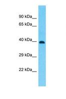 ZNF586 Antibody - Western blot of Human Thymus Tumor. ZNF586 antibody dilution 1.0 ug/ml.  This image was taken for the unconjugated form of this product. Other forms have not been tested.
