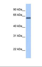 ZNF587 Antibody - Fetal brain lysate. Antibody concentration: 1.0 ug/ml. Gel concentration: 12%.  This image was taken for the unconjugated form of this product. Other forms have not been tested.