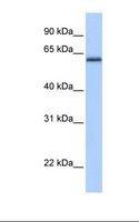 ZNF587 Antibody - Fetal brain lysate. Antibody concentration: 1.0 ug/ml. Gel concentration: 12%.  This image was taken for the unconjugated form of this product. Other forms have not been tested.