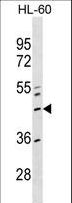 ZNF589 Antibody - ZNF589 Antibody western blot of HL-60 cell line lysates (35 ug/lane). The ZNF589 antibody detected the ZNF589 protein (arrow).