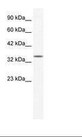 ZNF589 Antibody - HepG2 Cell Lysate.  This image was taken for the unconjugated form of this product. Other forms have not been tested.