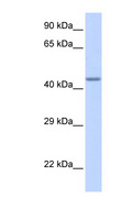 ZNF589 Antibody - ZNF589 antibody Western blot of Fetal Muscle lysate. This image was taken for the unconjugated form of this product. Other forms have not been tested.