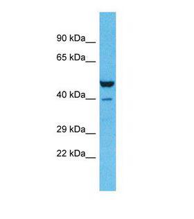 ZNF589 Antibody - Western blot of Human Lung Tumor. ZNF589 antibody dilution 1.0 ug/ml.  This image was taken for the unconjugated form of this product. Other forms have not been tested.