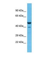 ZNF589 Antibody - Western blot of Human Lung Tumor. ZNF589 antibody dilution 1.0 ug/ml.  This image was taken for the unconjugated form of this product. Other forms have not been tested.