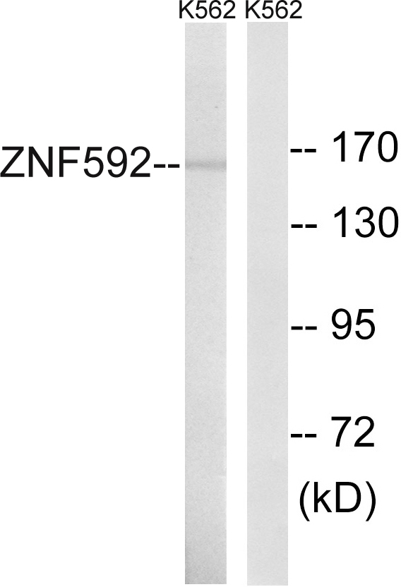 ZNF592 Antibody - Western blot analysis of lysates from K562 cells, using ZNF592 Antibody. The lane on the right is blocked with the synthesized peptide.