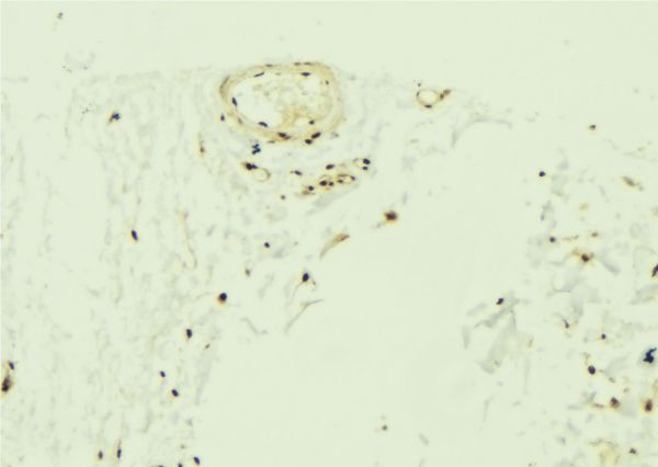 ZNF592 Antibody - 1:100 staining mouse muscle tissue by IHC-P. The sample was formaldehyde fixed and a heat mediated antigen retrieval step in citrate buffer was performed. The sample was then blocked and incubated with the antibody for 1.5 hours at 22°C. An HRP conjugated goat anti-rabbit antibody was used as the secondary.