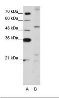 ZNF596 Antibody - A: Marker, B: Jurkat Cell Lysate.  This image was taken for the unconjugated form of this product. Other forms have not been tested.