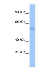 ZNF596 Antibody - Hela cell lysate. Antibody concentration: 0.5 ug/ml. Gel concentration: 8%.  This image was taken for the unconjugated form of this product. Other forms have not been tested.