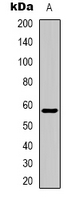 ZNF596 Antibody - Western blot analysis of ZNF596 expression in Jurkat (A) whole cell lysates.