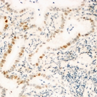 ZNF596 Antibody - Immunohistochemical analysis of ZNF596 staining in human kidney formalin fixed paraffin embedded tissue section. The section was pre-treated using heat mediated antigen retrieval with sodium citrate buffer (pH 6.0). The section was then incubated with the antibody at room temperature and detected with HRP and DAB as chromogen. The section was then counterstained with hematoxylin and mounted with DPX.