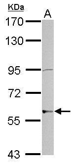 ZNF596 Antibody - Sample (30 ug of whole cell lysate) A: NT2D1 7.5% SDS PAGE ZNF596 antibody diluted at 1:2000