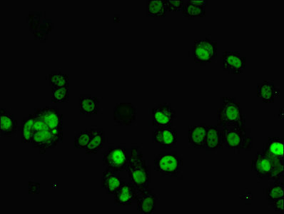 ZNF596 Antibody - Immunofluorescent analysis of MCF-7 cells using ZNF596 Antibody at dilution of 1:100 and Alexa Fluor 488-congugated AffiniPure Goat Anti-Rabbit IgG(H+L)