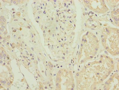ZNF596 Antibody - Immunohistochemistry of paraffin-embedded human kidney tissue using ZNF596 Antibody at dilution of 1:100